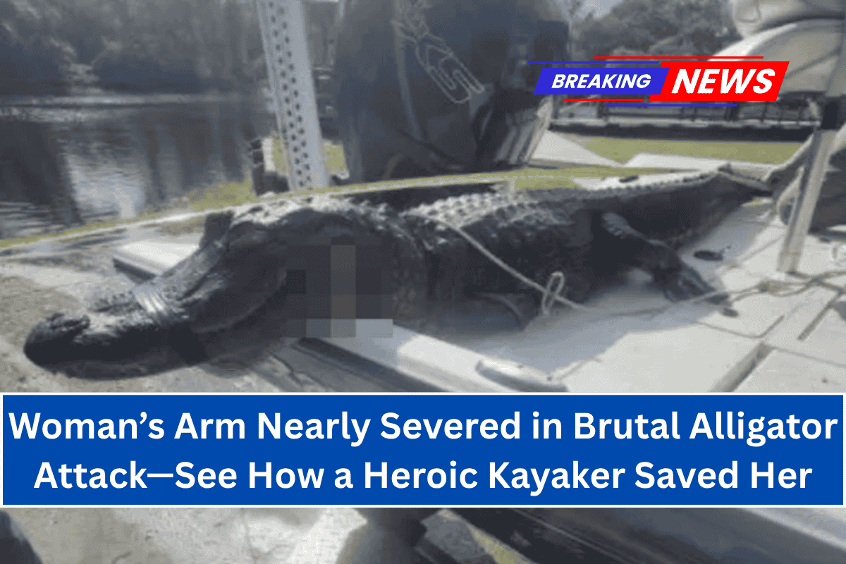 "Woman’s Arm Nearly Severed in Brutal Alligator Attack—See How a Heroic Kayaker Saved Her"