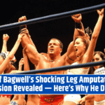 Buff Bagwell’s Shocking Leg Amputation Decision Revealed — Here’s Why He Did It!