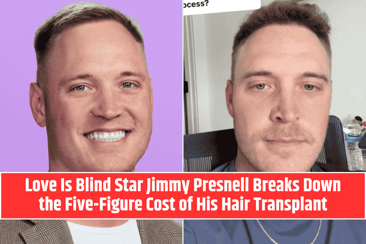 Love Is Blind Star Jimmy Presnell Breaks Down the Five-Figure Cost of His Hair Transplant